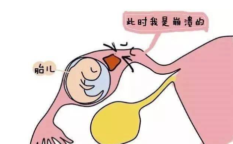 懷孕hcg值多高才算正常？看這個(gè)對(duì)照表就知道