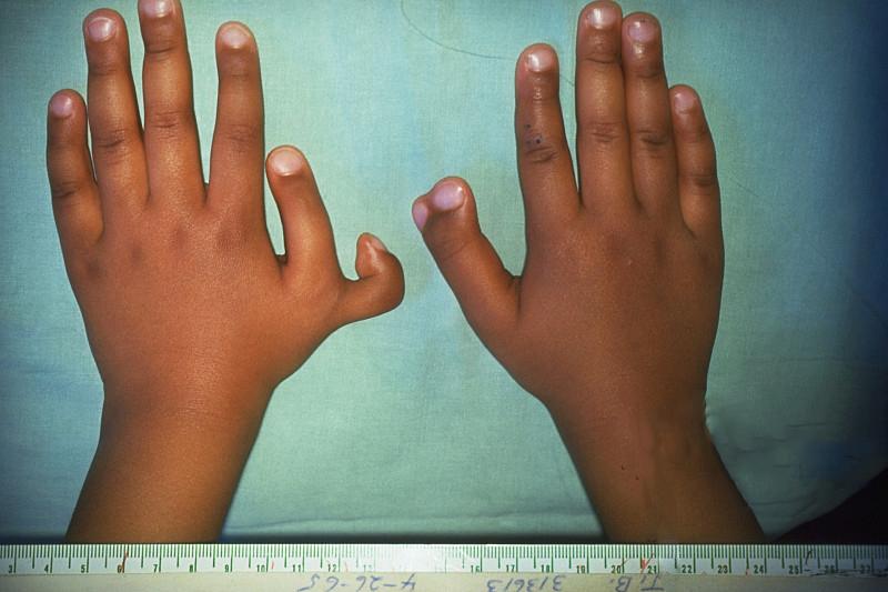 你適合生第**嗎？