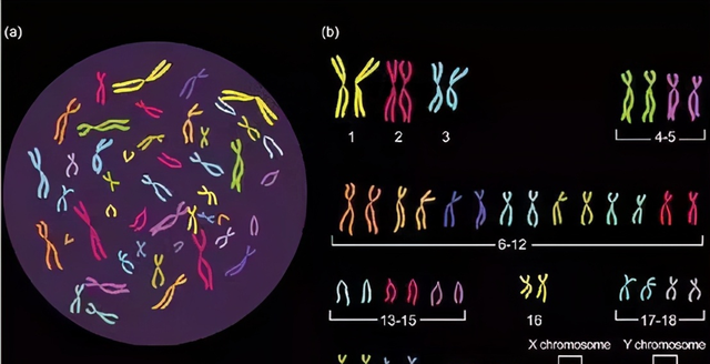 染色體+精子質(zhì)量三大檢查，男性孕前必查利器