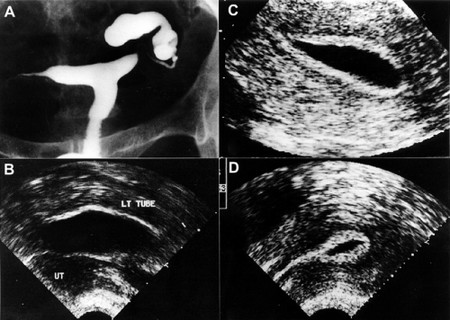如何自我檢查不孕，可以看完這些步驟！