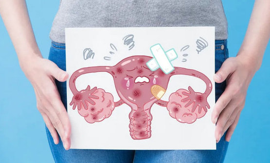 30歲女性子宮內(nèi)膜異位1到4期區(qū)別，嚴(yán)重程度、病變范圍都很明顯