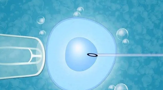 高齡做試管嬰兒成功率到底有多少？