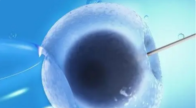 高齡做試管嬰兒一般來說成功率能多高？