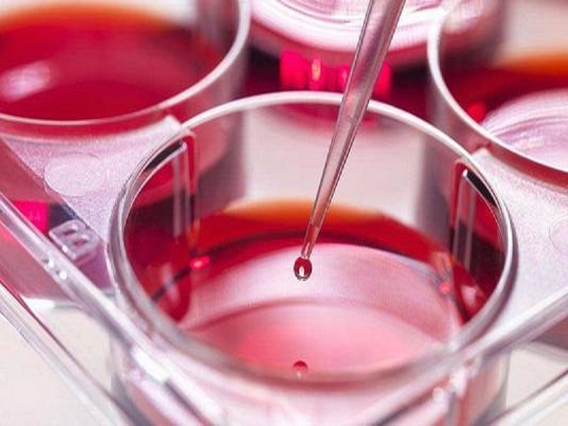 俄羅斯試管嬰兒攻略