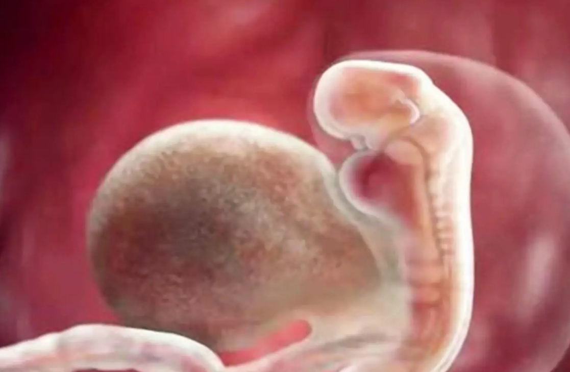 女性兩側(cè)輸卵管結(jié)扎后做試管移植會(huì)發(fā)生宮外孕嗎？