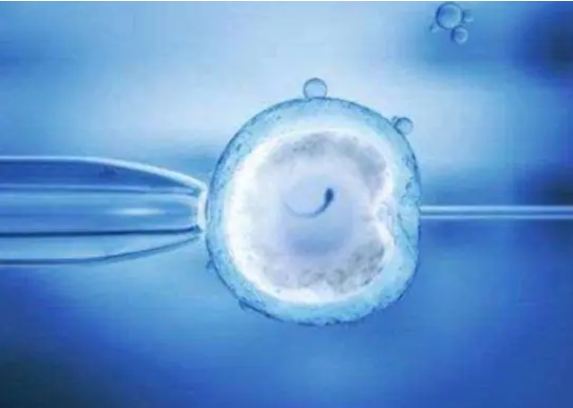 試管囊胚移植后出血需要做保胎措施嗎？