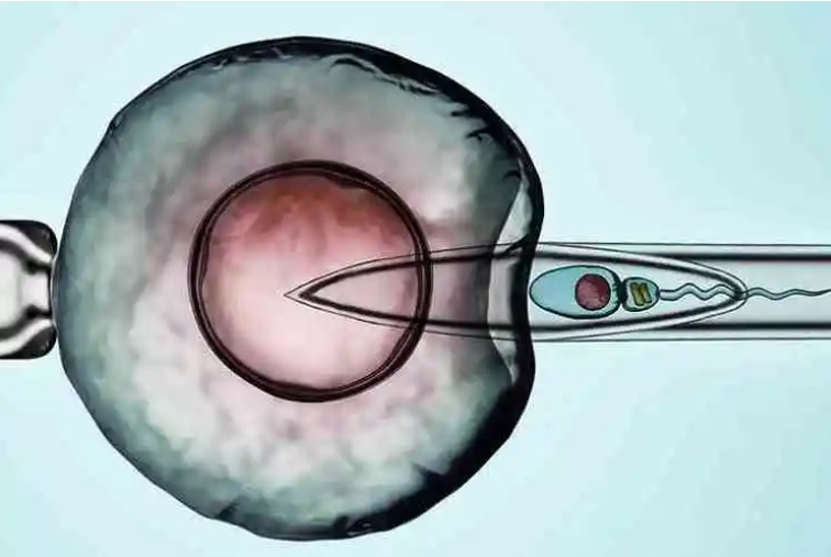 試管短方案和長方案怎么選？哪個(gè)成功率比較高？