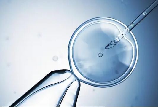 女性雙側(cè)卵巢共有13個卵泡是多囊卵巢綜合征嗎？