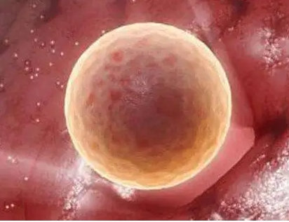 卵巢早衰患者在日常生活中要注意什么？