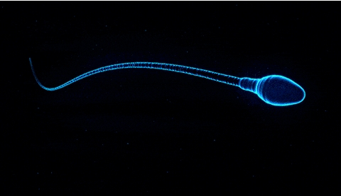 在試管嬰兒自然周期需要保胎嗎？如何進(jìn)行保胎？