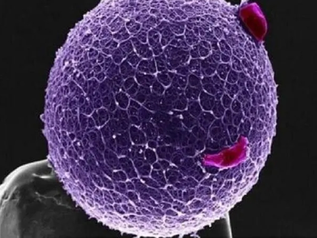 三代試管技術(shù)可以篩除掉馬凡綜合征基因嗎？