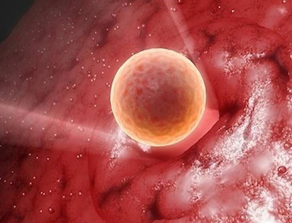 針灸有什么作用？對試管嬰兒移植有影響嗎？