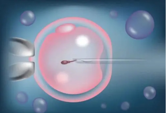  雙側(cè)輸卵管不全梗阻是嚴(yán)重的不孕癥嗎？如何治療？