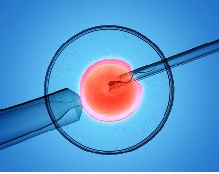 女性高血壓做試管嬰兒可以成功懷孕生子嗎？