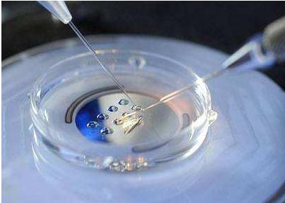 患有輸卵管堵塞做試管嬰兒需要提前切除嗎？