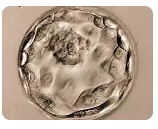 如何選擇適合自己的試管嬰兒周期方案？考慮哪些因素？