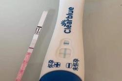 揭陽試管嬰兒降調(diào)用什么藥？揭陽試管嬰兒降調(diào)常用藥達必佳！揭陽試管嬰兒降調(diào)藥達必佳注射方法介紹