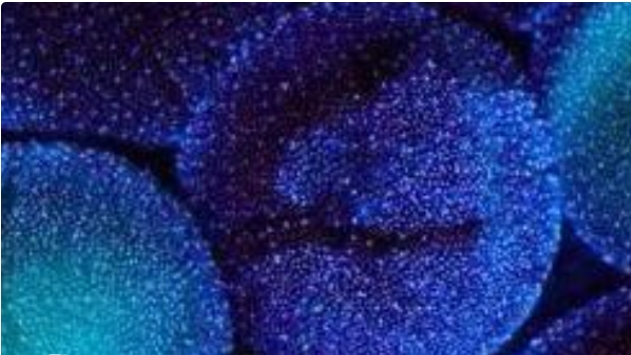 高齡做試管嬰兒需要注意哪幾個地方？