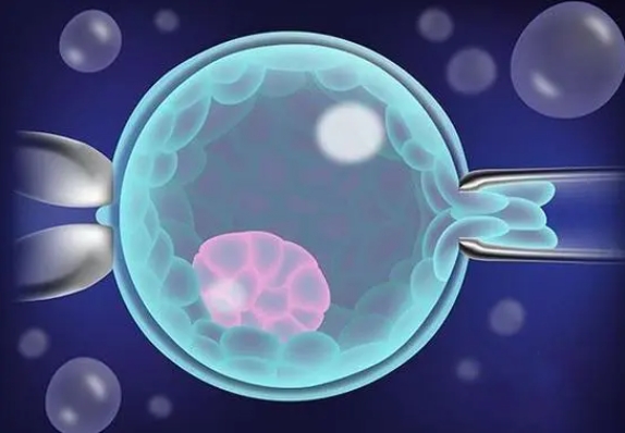  第一次做試管嬰兒成功率一般有多少？