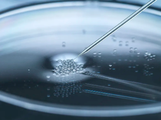 進口干細胞治療眼袋效果好嗎？真實案例分享！