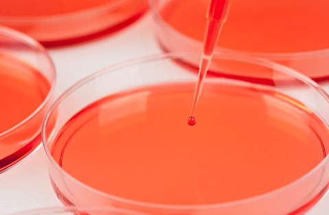 干細(xì)胞移植治療腎癌需要多少費(fèi)用？成功率如何？