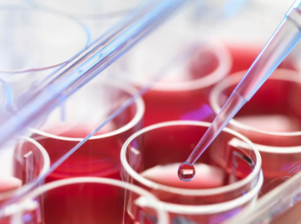 張愛民干細胞療法的效果與評價如何？