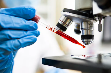 干細胞移植治療白血病效果如何？如何選擇最佳干細胞移植醫(yī)院？