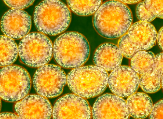 干細胞療法如何改善疾病癥狀？它的具體功效有哪些？