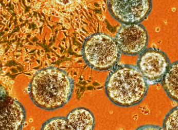 魏則西事件中干細(xì)胞治療法是什么？