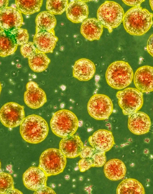 深圳哪家干細(xì)胞機(jī)構(gòu)口碑比較好？哪家值得推薦？