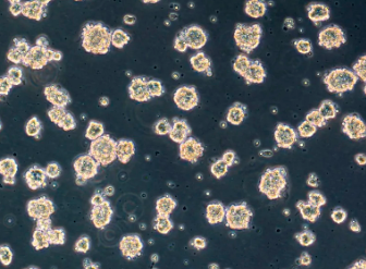 造血干細(xì)胞移植哪家醫(yī)院好？如何提高移植成功率？