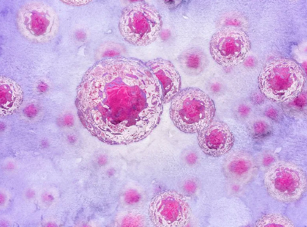 臺(tái)州糖尿病干細(xì)胞功效及治療實(shí)例分析。