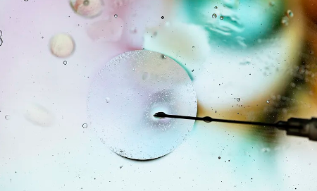 干細胞治療癲癇病效果如何？有哪些成功案例？