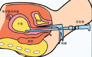 中信雅湘試管嬰兒醫(yī)生排名？試管助孕好評最多專家介紹