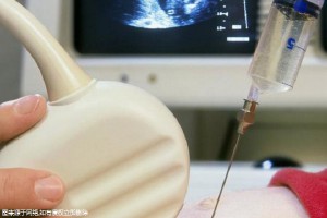 在金華做試管嬰兒費用,三項開支匯總大概需要6萬元