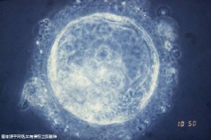 宣城試管嬰兒得花多少錢(qián)