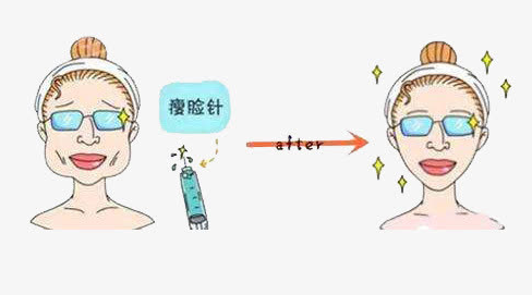 在鄭州去公立醫(yī)院打瘦臉針好，還是私立醫(yī)院好？