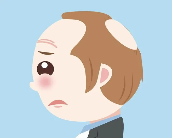 脫發(fā)該知道哪些小知識？