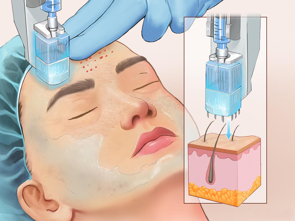 中國機(jī)打水光前50名整形醫(yī)院不踩雷大推薦！
