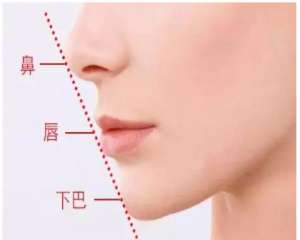 西雙版納自體耳軟骨自體耳軟骨隆鼻手術(shù)怎么樣？