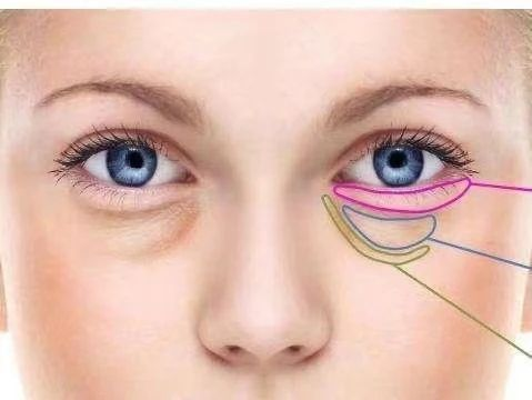 蘇州市消眼袋整形醫(yī)生實力排行！建議收藏