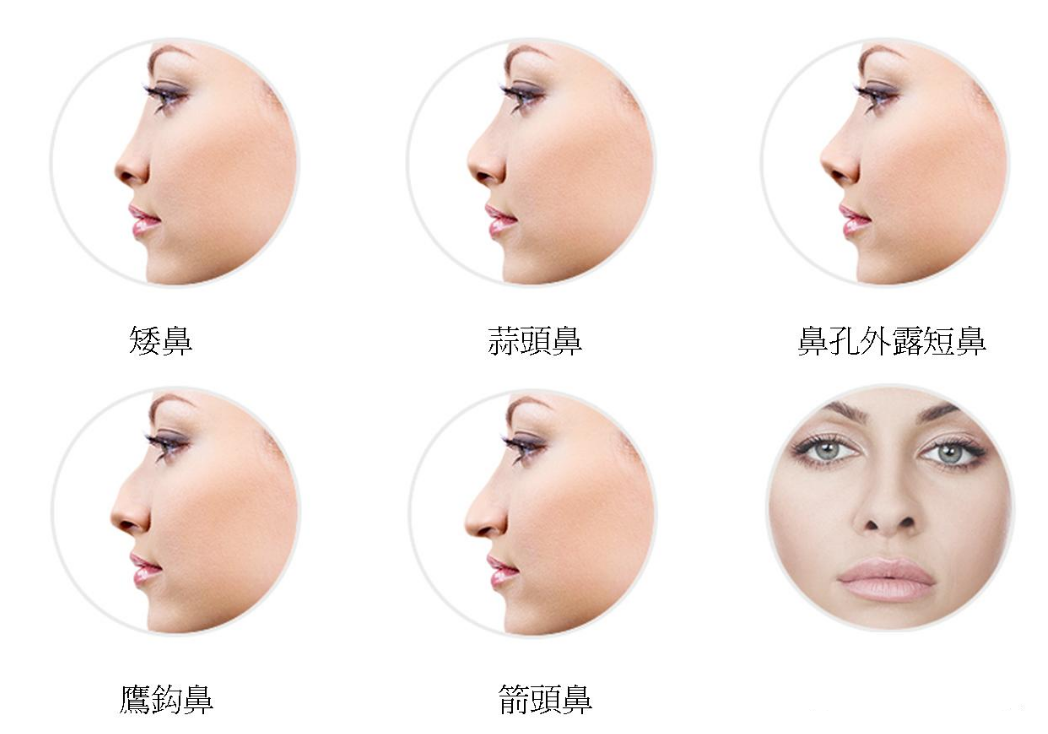 蚌埠市自體脂肪注射隆鼻整形醫(yī)院紅榜大盤點(diǎn)！