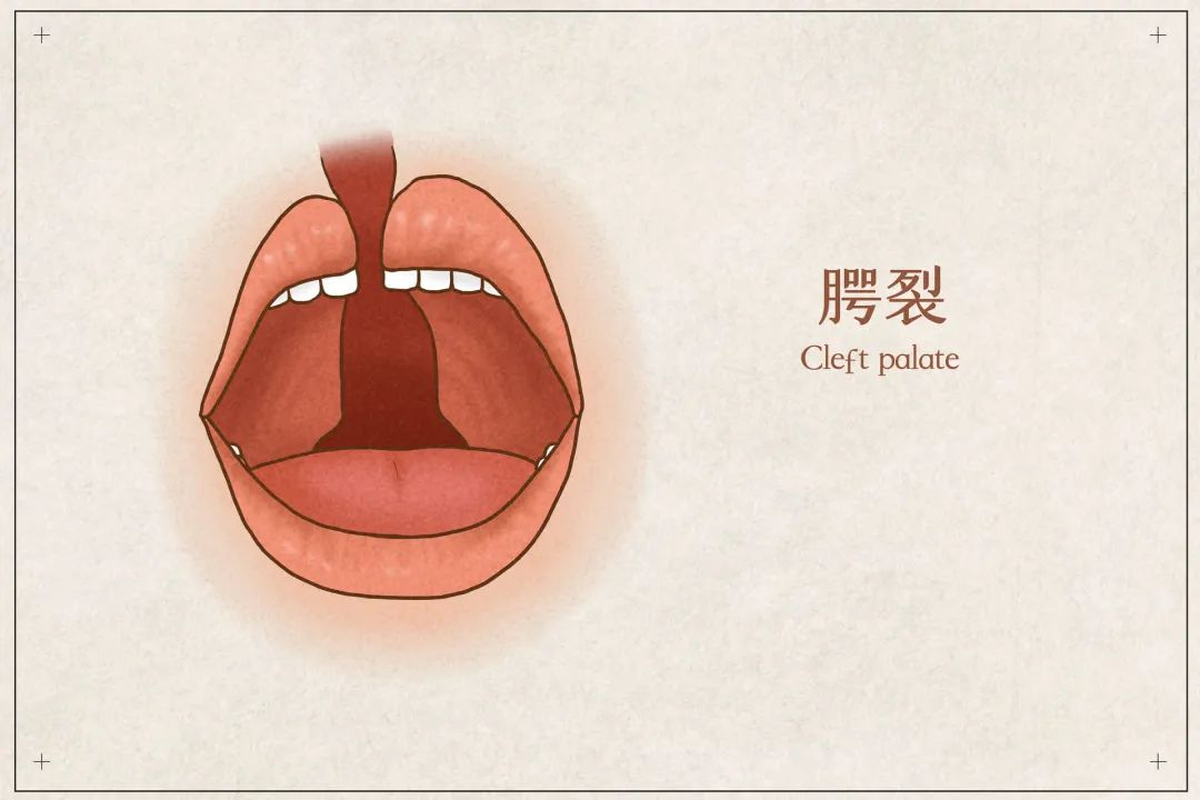 遵義市唇腭裂手術(shù)矯正這五位醫(yī)生實(shí)力出眾！