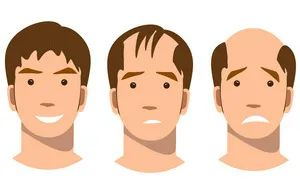 大同市毛發(fā)種植認(rèn)準(zhǔn)這幾家醫(yī)院準(zhǔn)沒錯(cuò)！