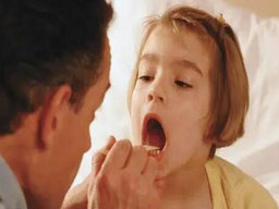 小孩上火嗓子疼吃什么藥好