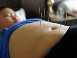 肥胖癥中醫(yī)治療方法有哪些