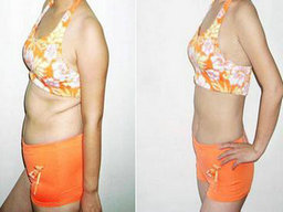 吃減肥藥真的有用嗎