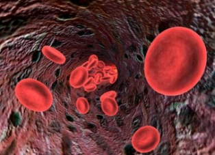 地中海中度貧血怎么治