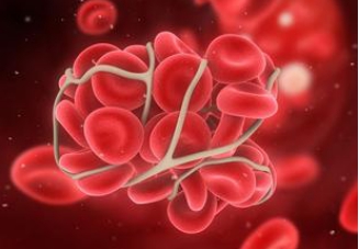 慢性再生障礙性貧血怎么治療